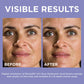 L'Oreal Paris Revitalift Derm Intensives® 1.5% Hyaluronic Acid Serum - Fragrance free