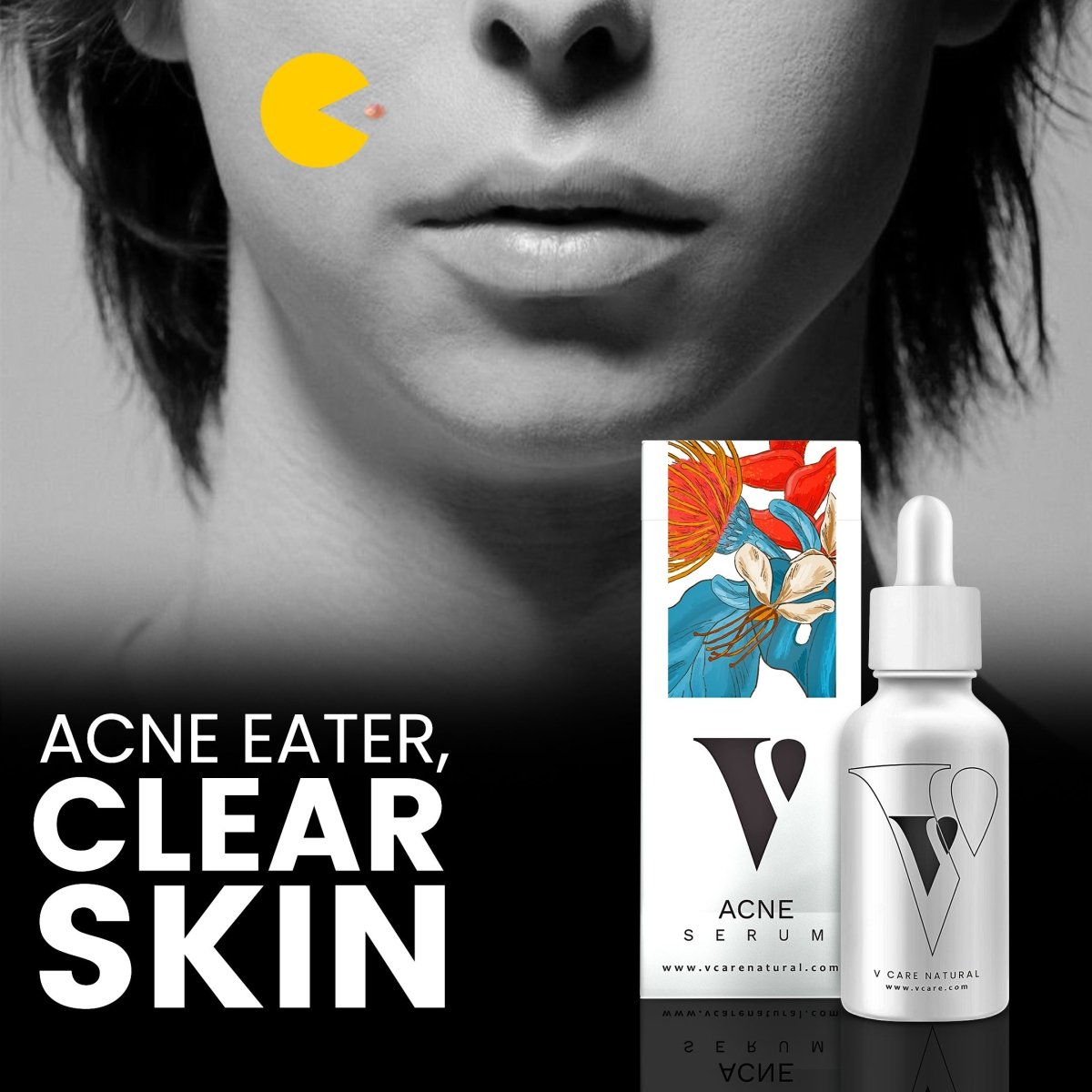 VCare Natural Acne Serum