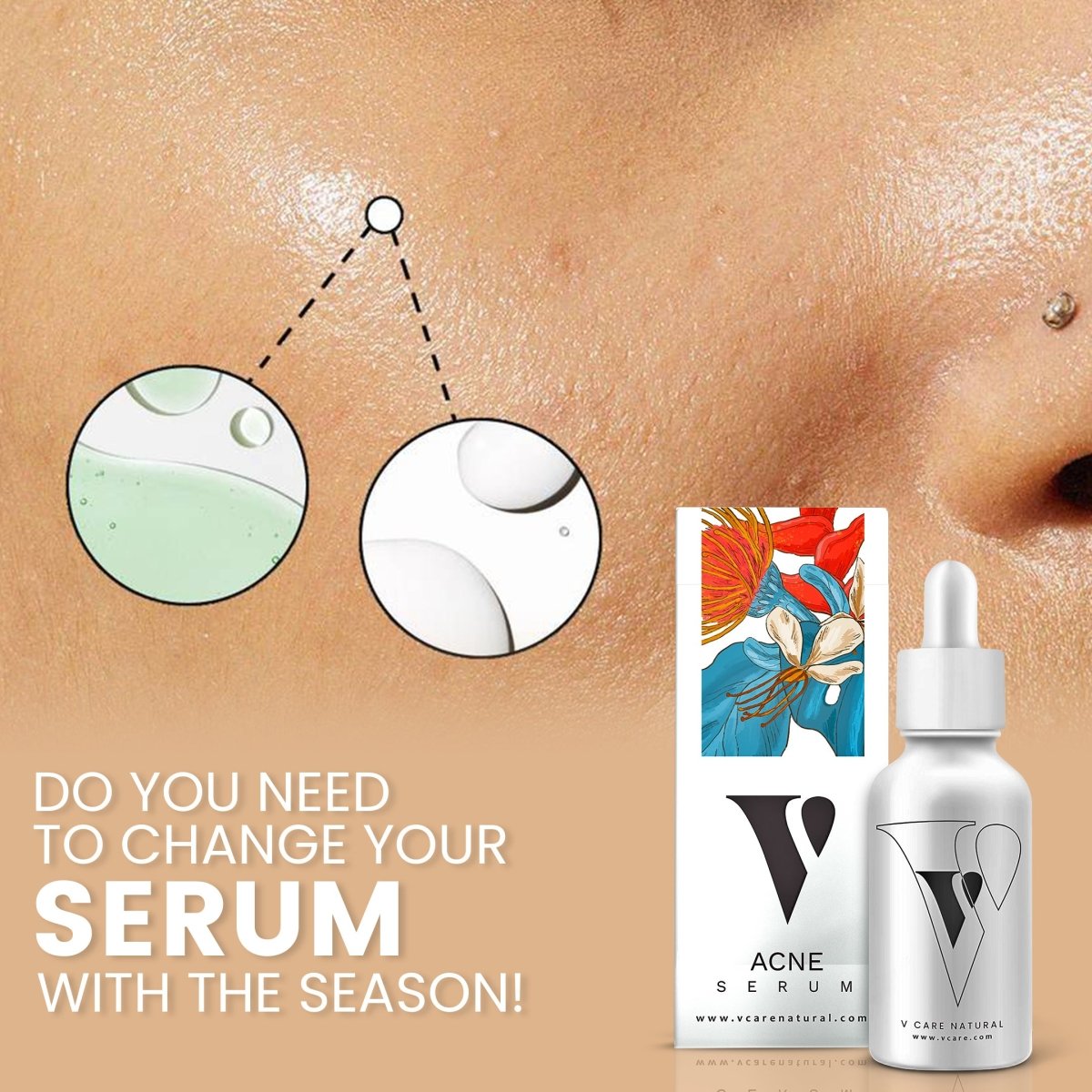 VCare Natural Acne Serum