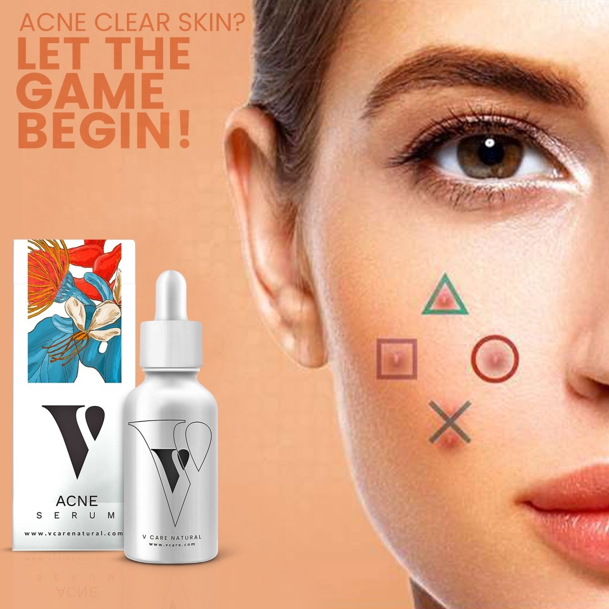 VCare Natural Acne Serum